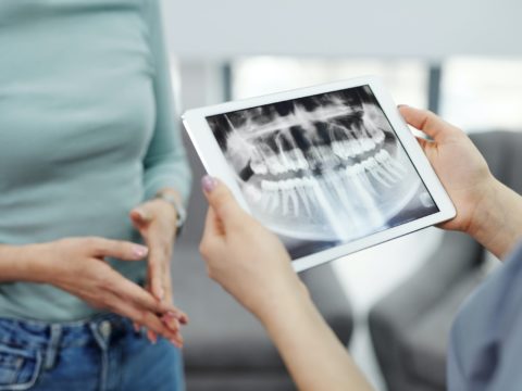 8 Dental Problems Associated with Auto Accidents