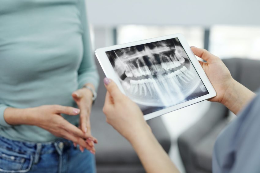 8 Dental Problems Associated with Auto Accidents